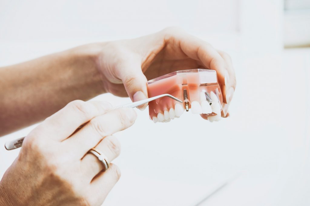 Reasons To Pick Dental Implants Over Dentures in Coconut Creek